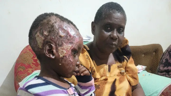 Help Give Jjagwe Joel a Future: Support His Treatment and Education for next term